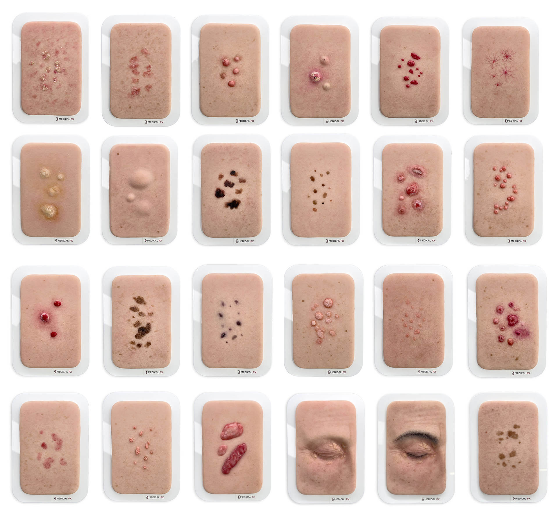 Set aus 23 Pocketwunden - Hautveränderungen – Bild 1