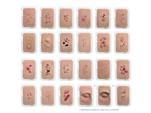 Ensemble complet Pocket Wound – 23 modèles dermatologiques