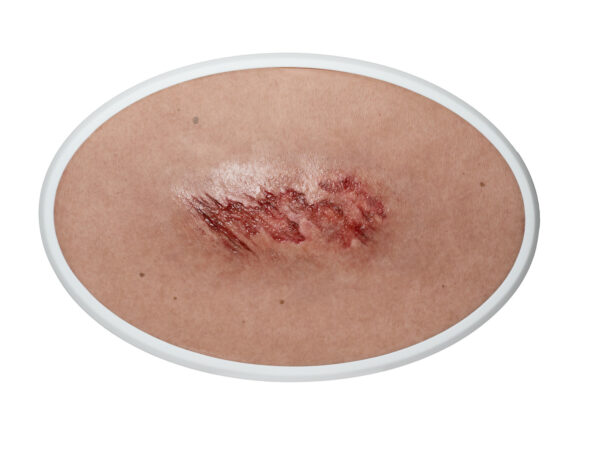 Frame Model Abrasion