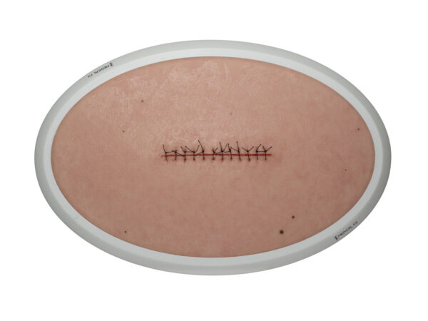 Rahmenmodell Operationswunde mit Naht ohne Entzündungserscheinungen – Bild 1