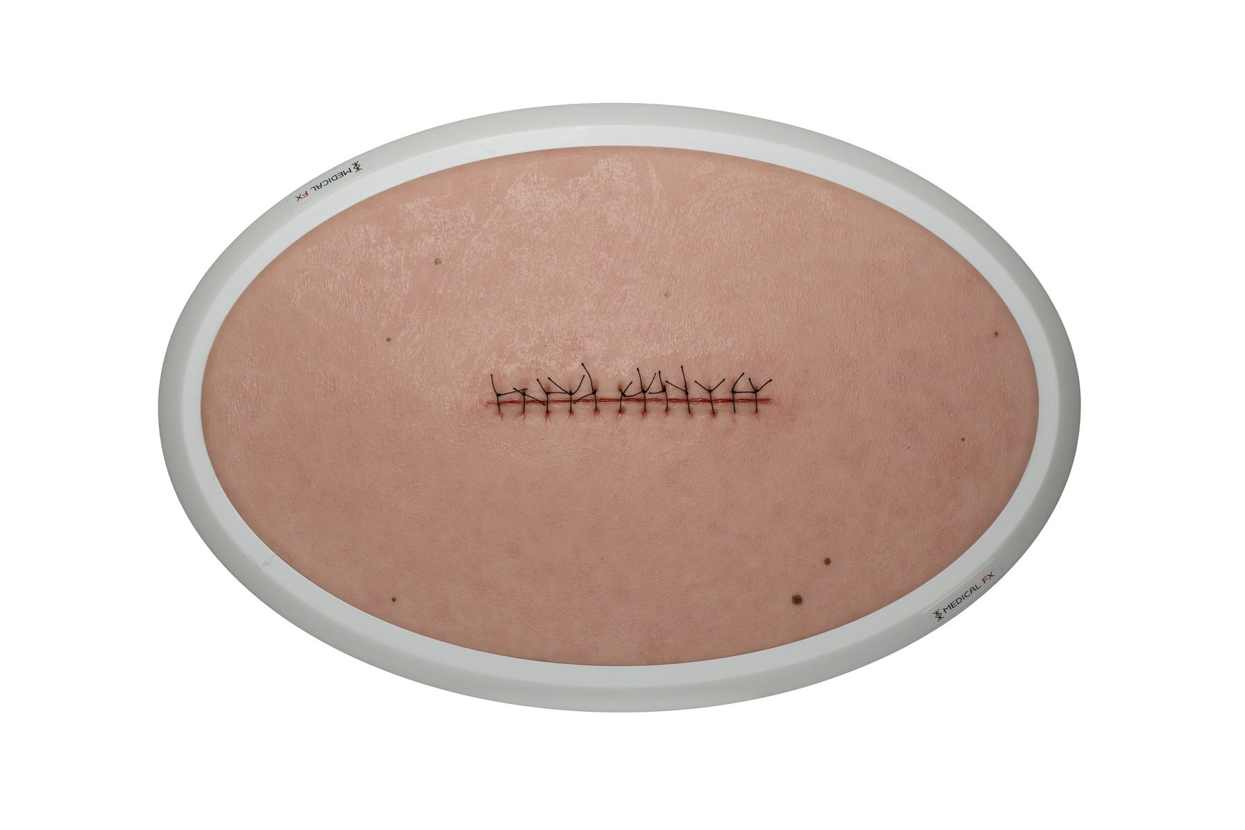 Rahmenmodell Operationswunde mit Naht ohne Entzündungserscheinungen – Bild 1