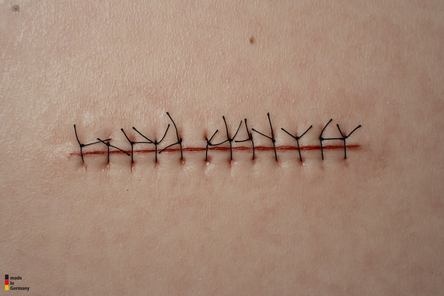 Rahmenmodell Operationswunde mit Naht ohne Entzündungserscheinungen – Bild 4