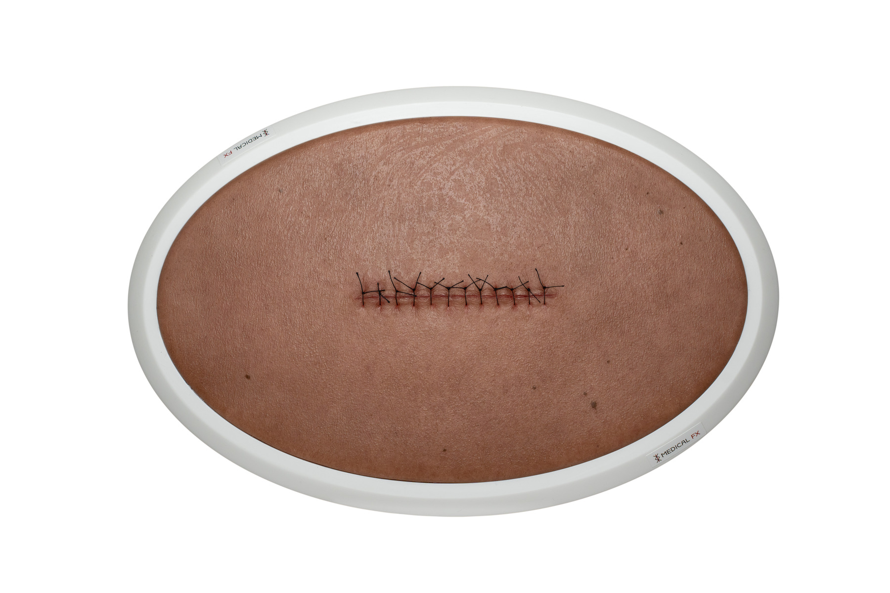 Rahmenmodell Operationswunde mit Naht ohne Entzündungserscheinungen – Bild 5