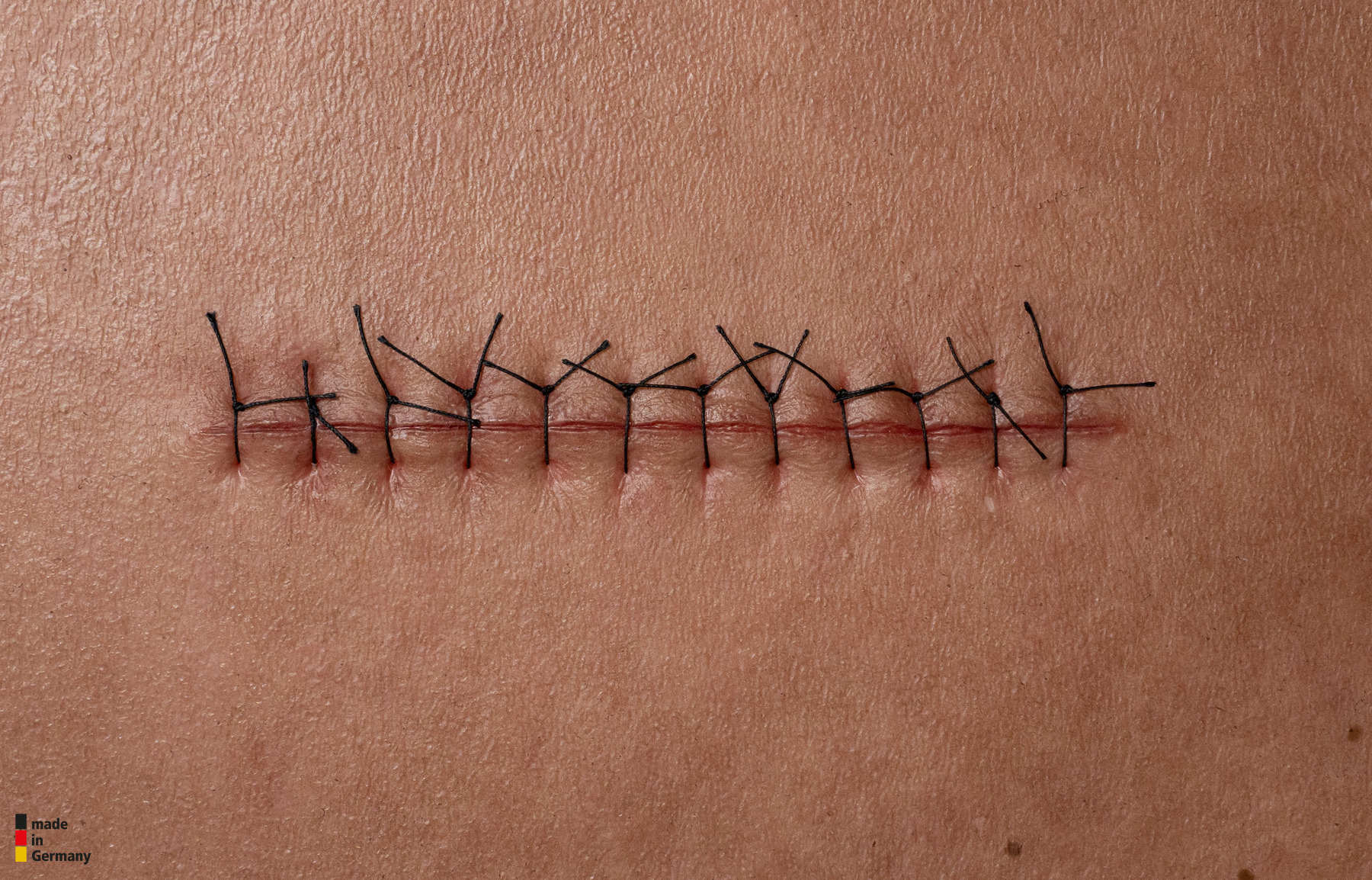 Rahmenmodell Operationswunde mit Naht ohne Entzündungserscheinungen – Bild 3