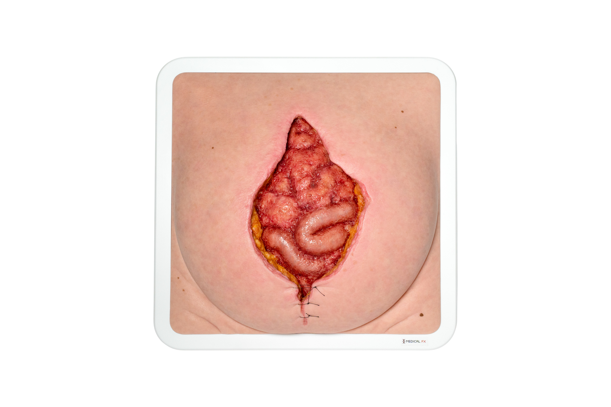 Rahmenmodell Platzbauch – Bild 1