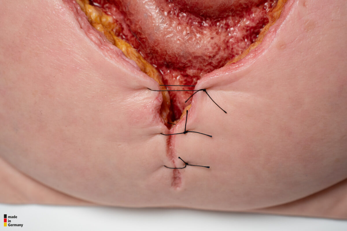 Rahmenmodell Platzbauch