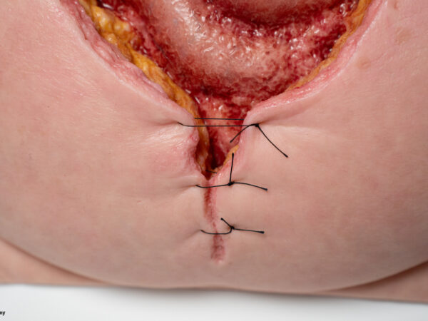 Rahmenmodell Platzbauch – Bild 4