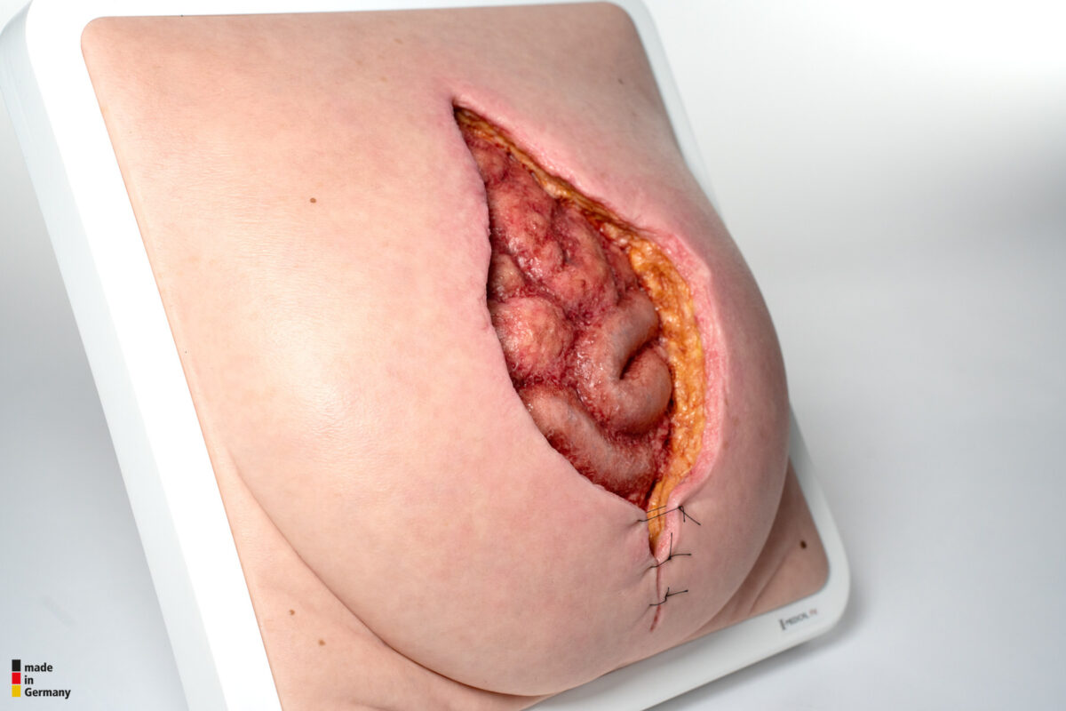 Rahmenmodell Platzbauch