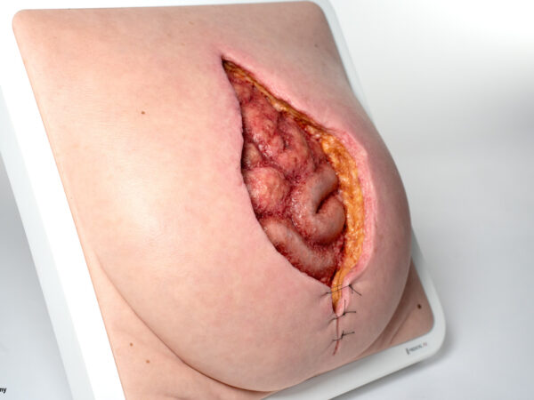 Rahmenmodell Platzbauch – Bild 3
