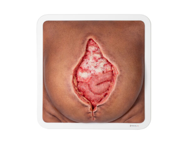 Rahmenmodell Platzbauch – Bild 23