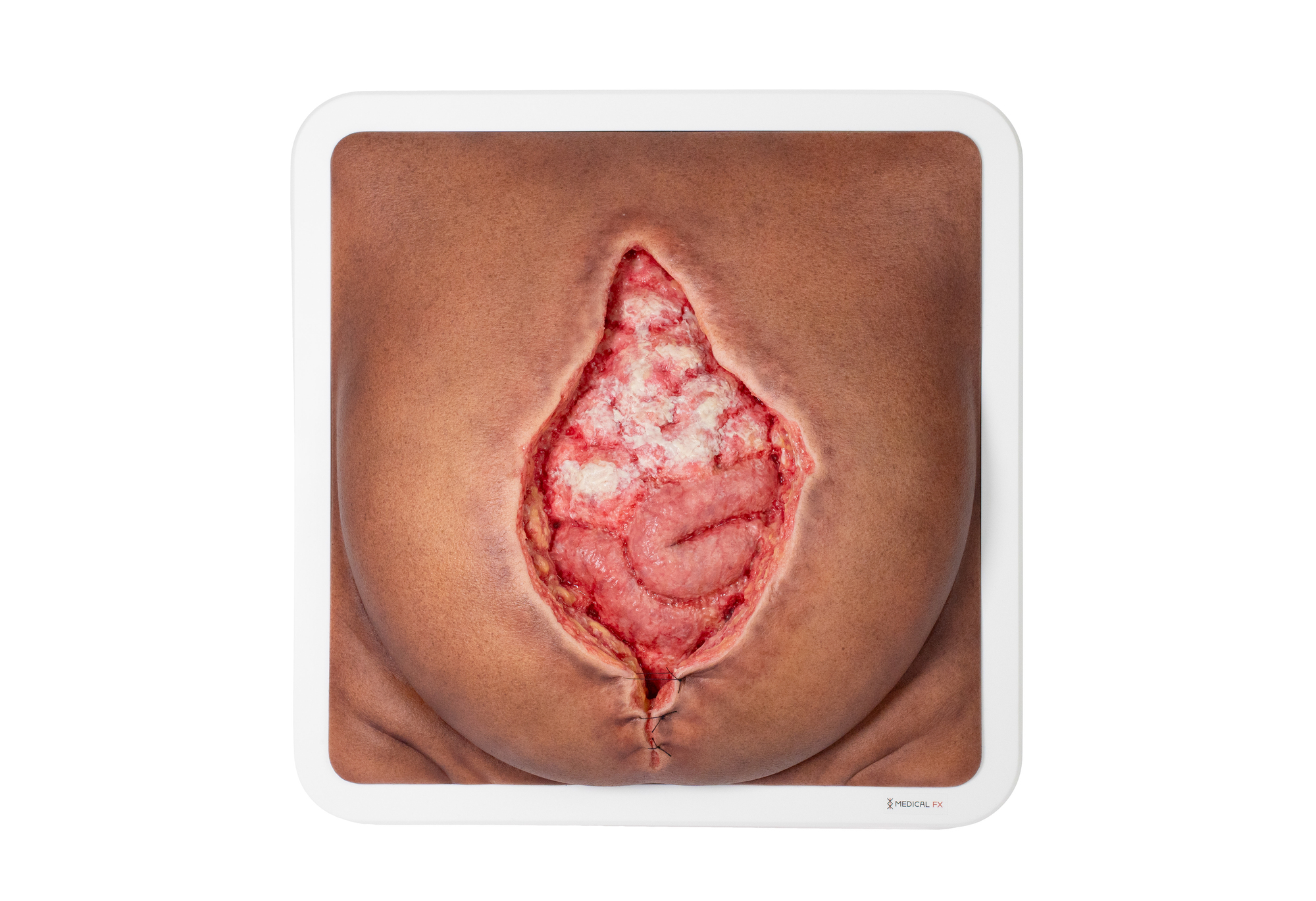 Rahmenmodell Platzbauch – Bild 23