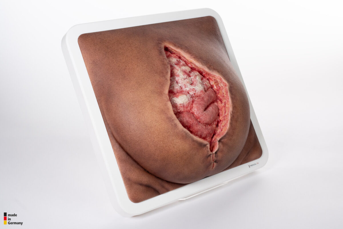 Rahmenmodell Platzbauch