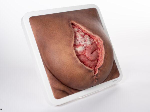 Rahmenmodell Platzbauch – Bild 7