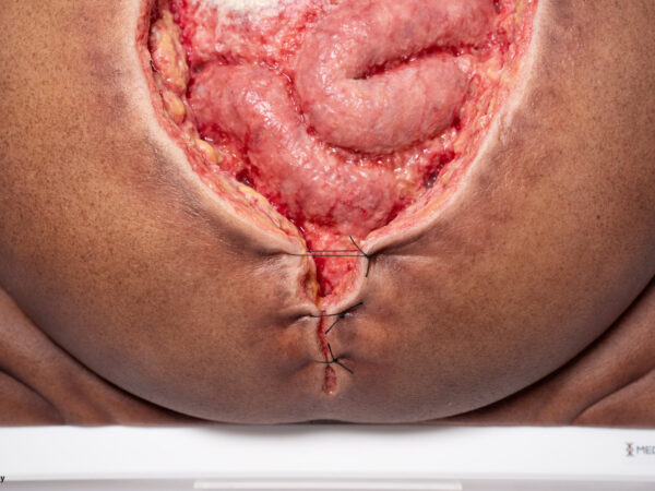 Rahmenmodell Platzbauch – Bild 9