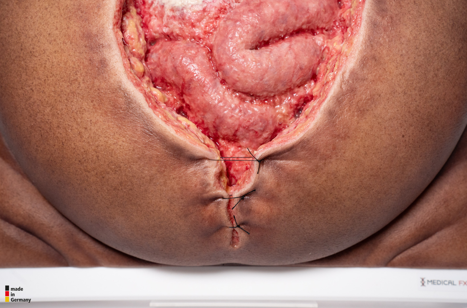 Rahmenmodell Platzbauch – Bild 9