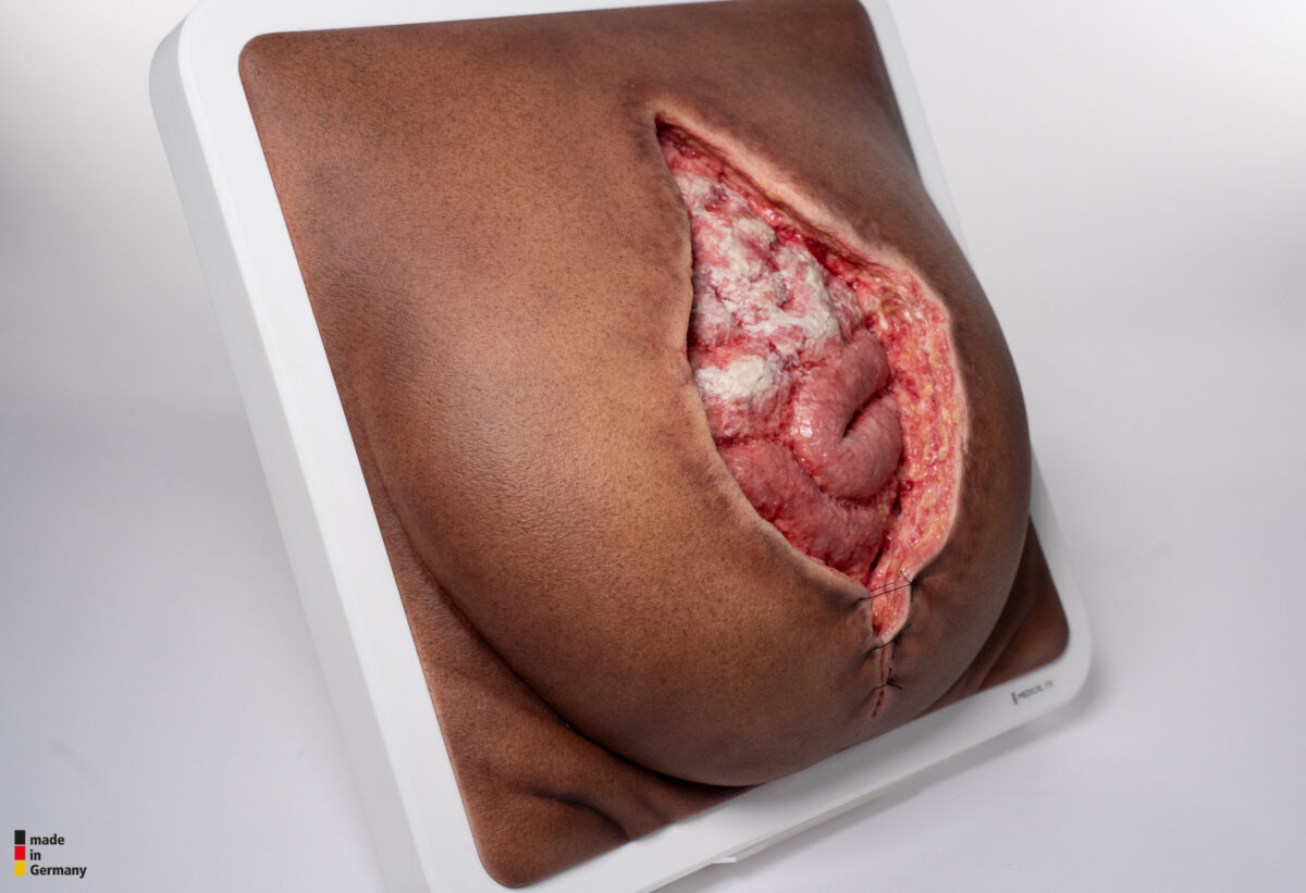 Rahmenmodell Platzbauch