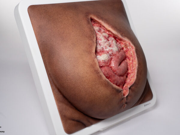 Rahmenmodell Platzbauch – Bild 10