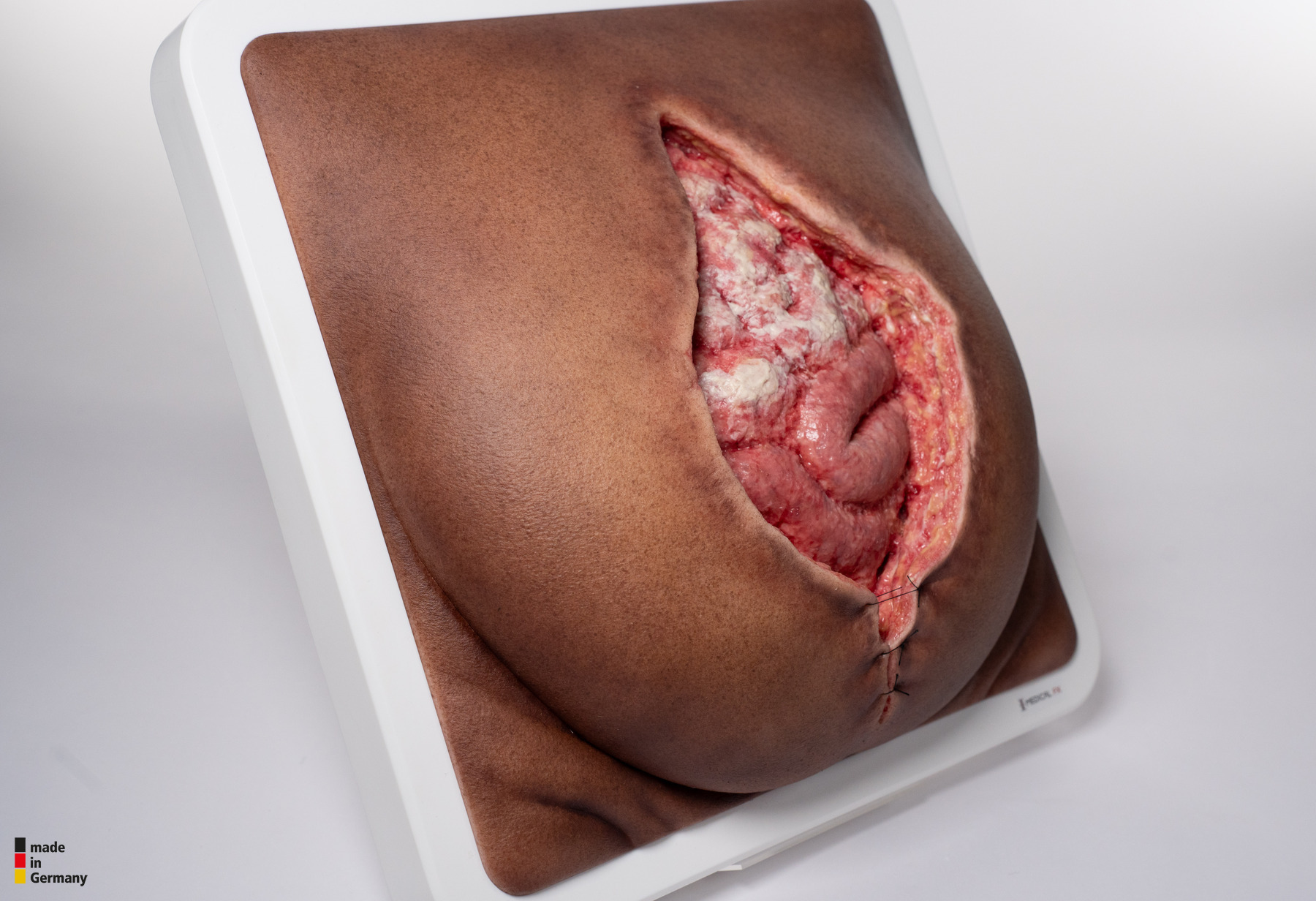 Rahmenmodell Platzbauch – Bild 10
