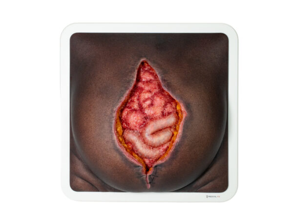 Rahmenmodell Platzbauch – Bild 24