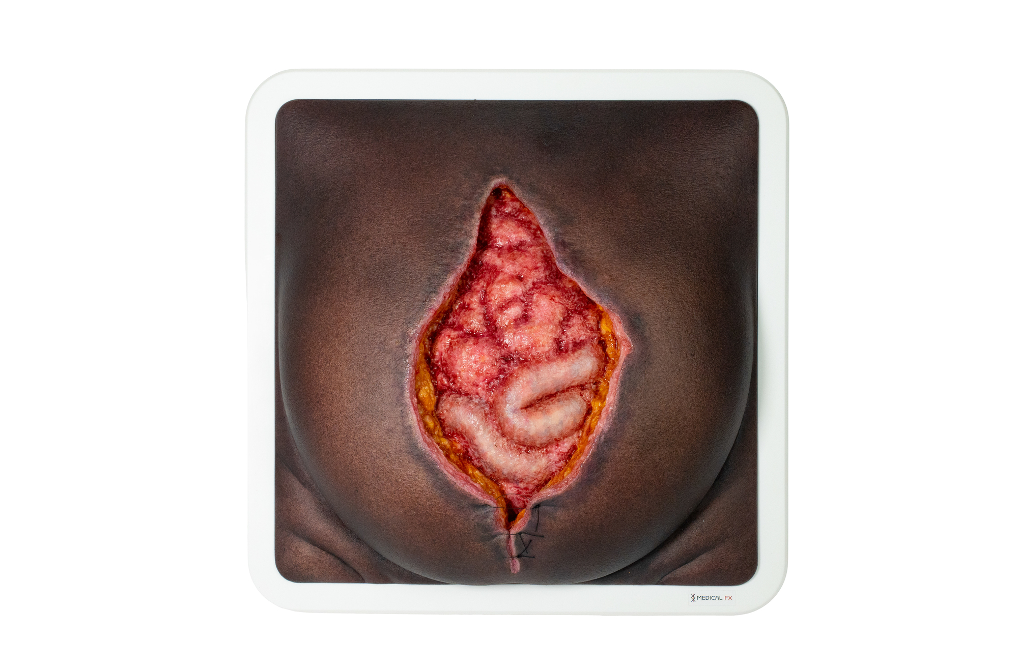 Rahmenmodell Platzbauch – Bild 24