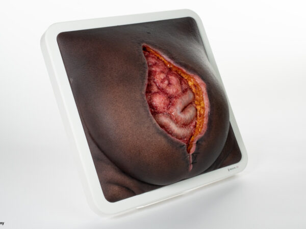 Rahmenmodell Platzbauch – Bild 12