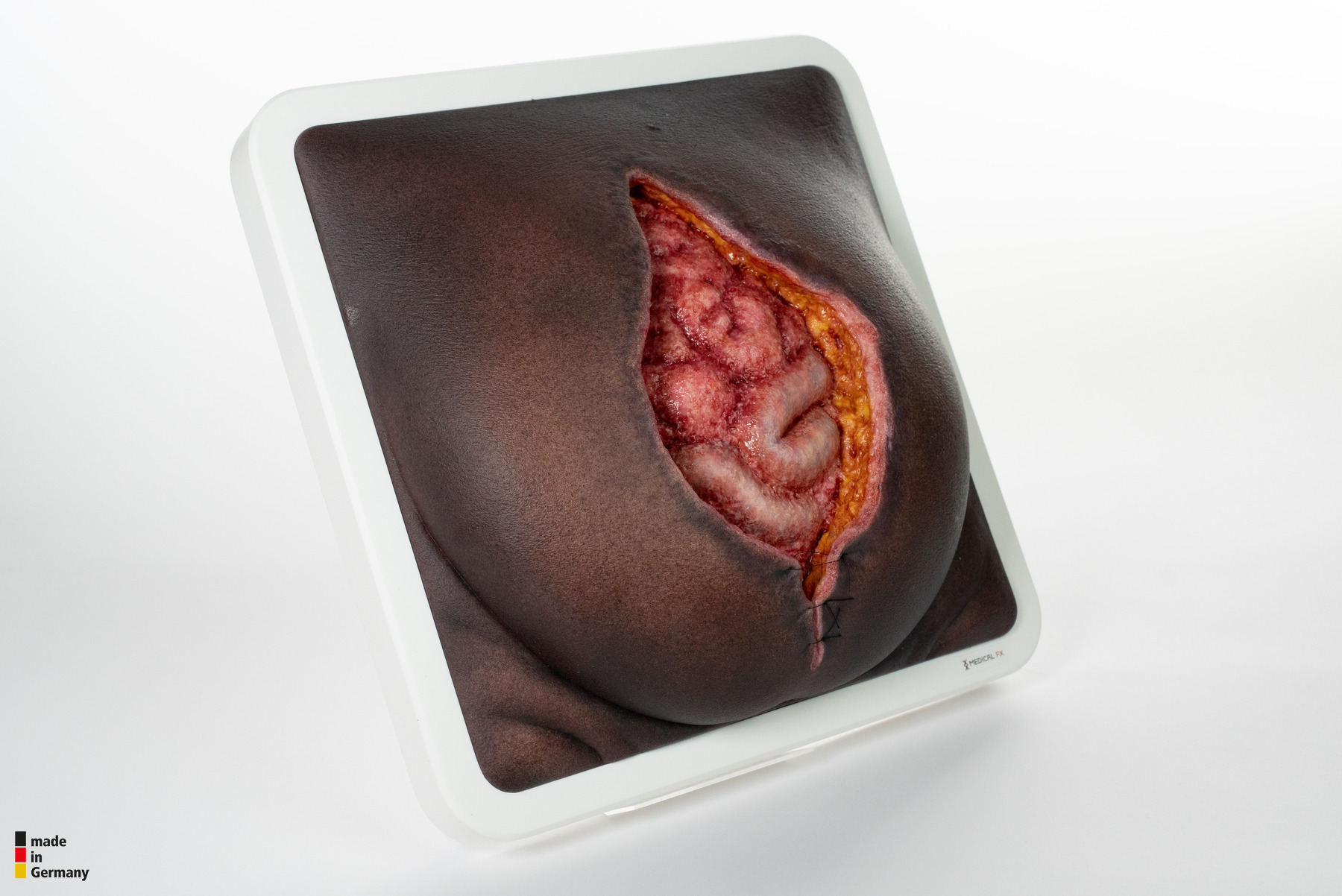 Rahmenmodell Platzbauch – Bild 12