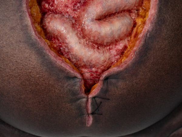 Rahmenmodell Platzbauch – Bild 13