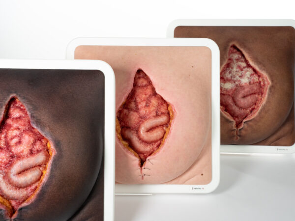 Rahmenmodell Platzbauch – Bild 5