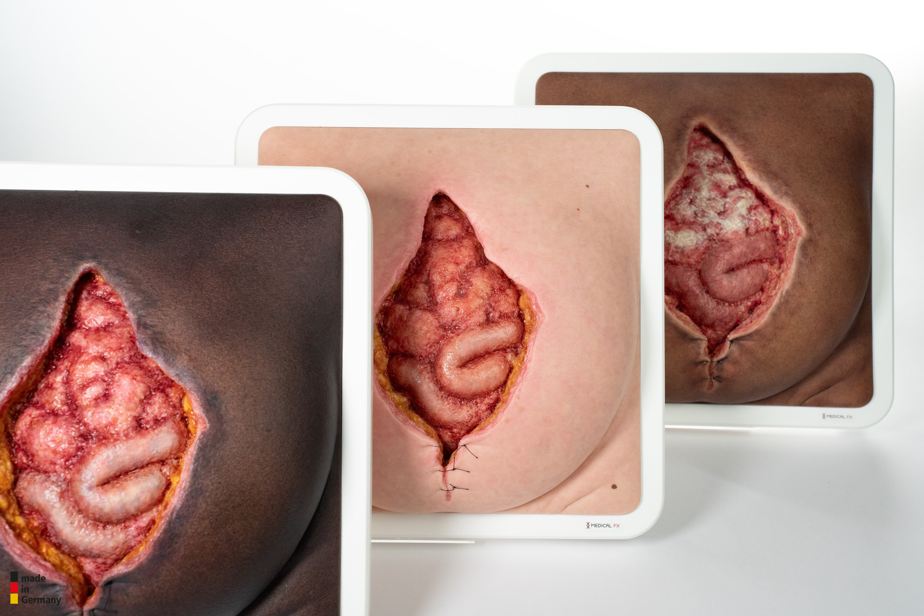 Rahmenmodell Platzbauch – Bild 5
