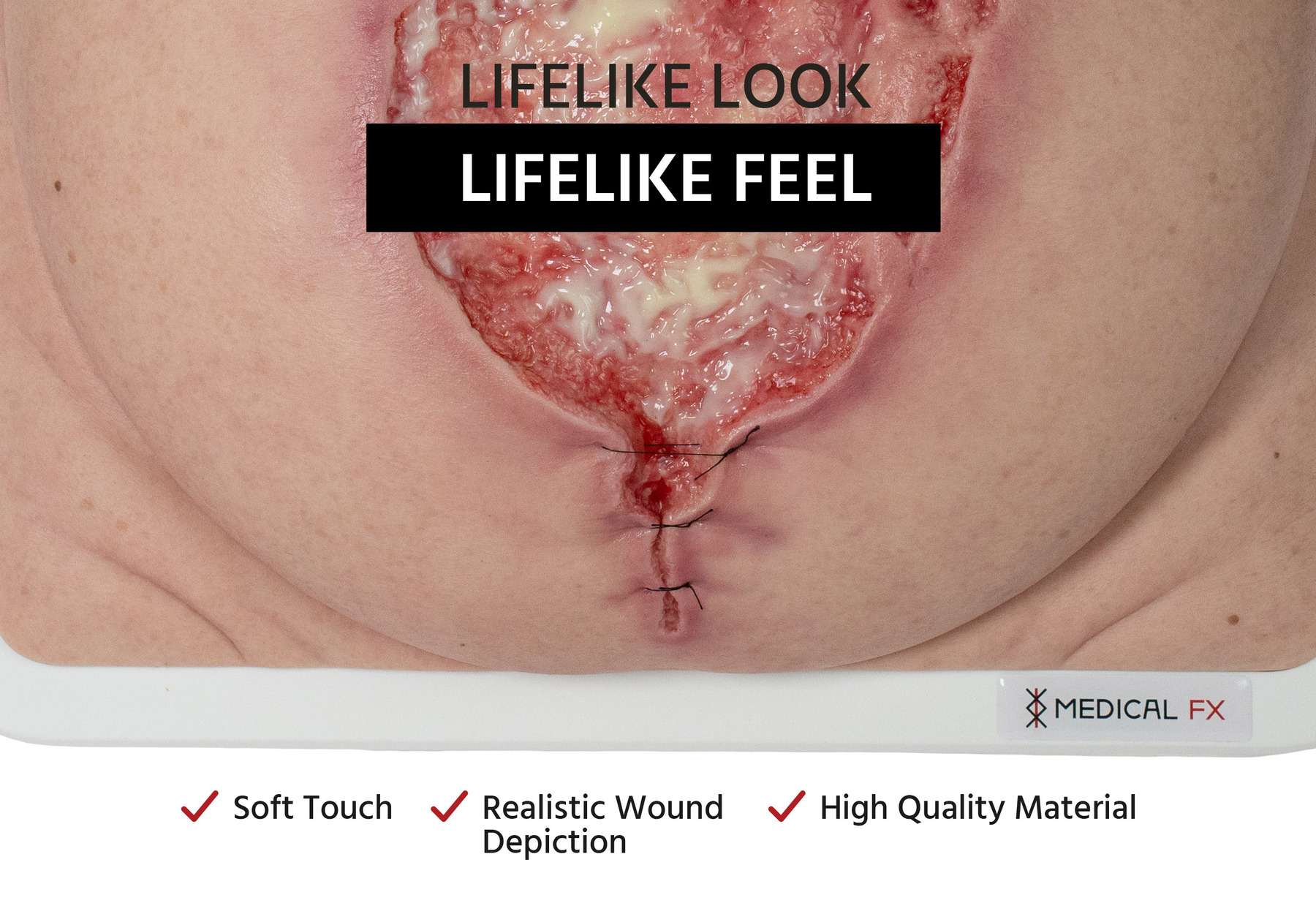 Frame Model 육아 조직이 있는 파열된 복부 - Image 2