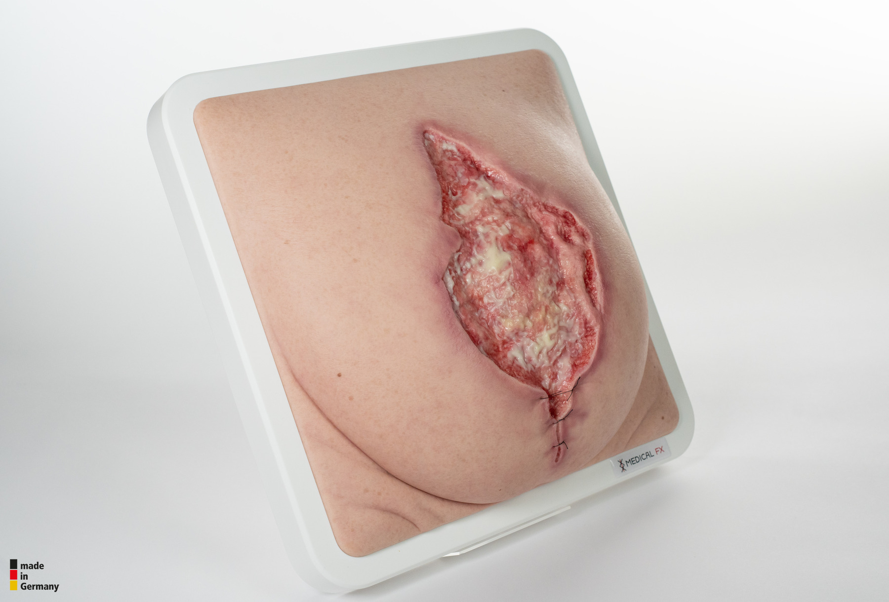 Frame Model 육아 조직이 있는 파열된 복부 - Image 5