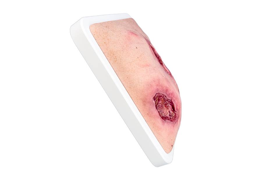 Das „Rahmenmodell Gesäß- und Hüftdekubitus“ von MEDICAL FX Germany ist eine präzise Nachbildung eines fortgeschrittenen Druckgeschwürs im Sakralbereich mit tiefer Wundtasche (Unte…
