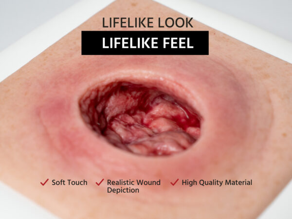 Frame Model Pressure Ulcer with Smooth Wound Edge - Image 2