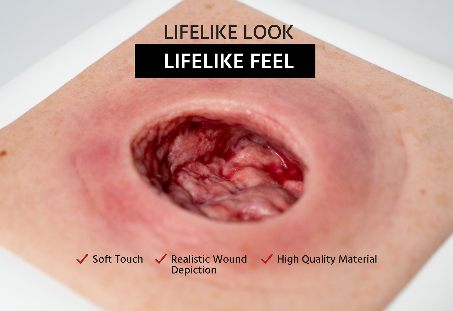 Frame Model Pressure Ulcer with Smooth Wound Edge - Image 2