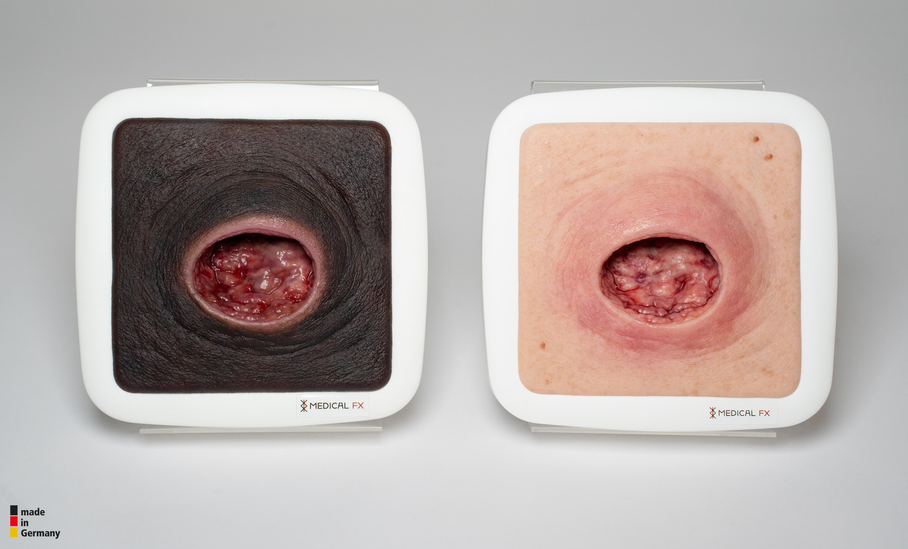 Frame Model Pressure Ulcer with Smooth Wound Edge - Image 3