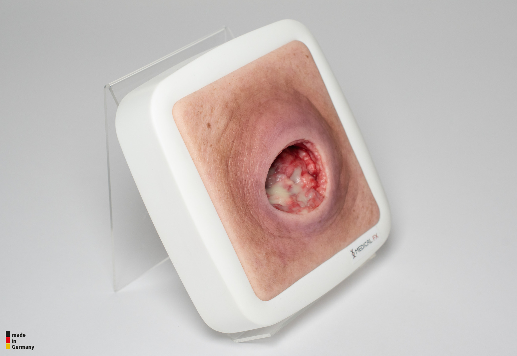 Frame Model Pressure Ulcer with Smooth Wound Edge - Image 9