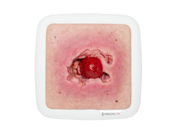 Rahmenmodell Stomaausriss – Bild 1