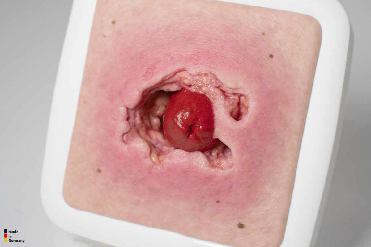 Rahmenmodell Stomaausriss