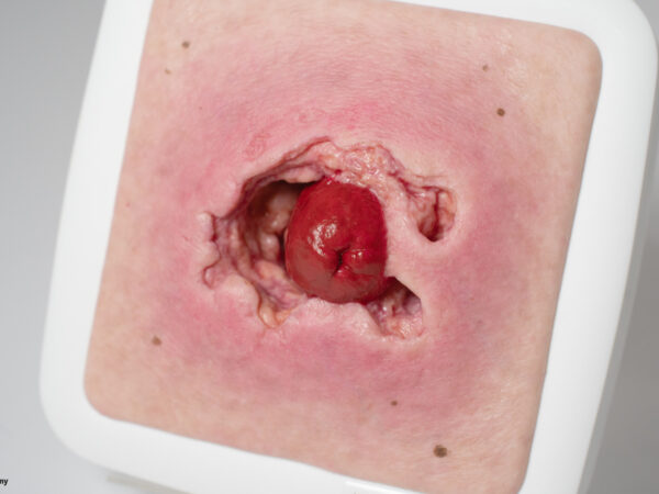 Rahmenmodell Stomaausriss – Bild 3