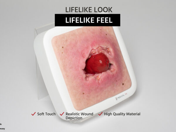 Rahmenmodell Stomaausriss – Bild 2