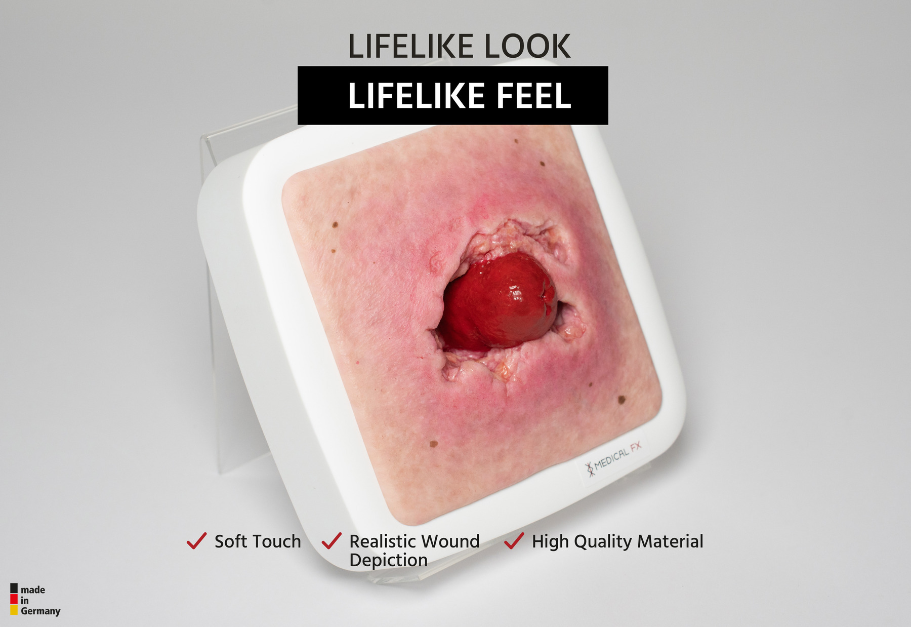 Rahmenmodell Stomaausriss – Bild 2