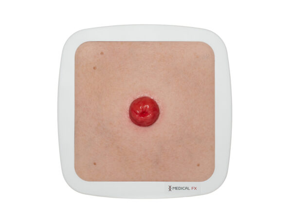 Frame Model Stoma Perfect