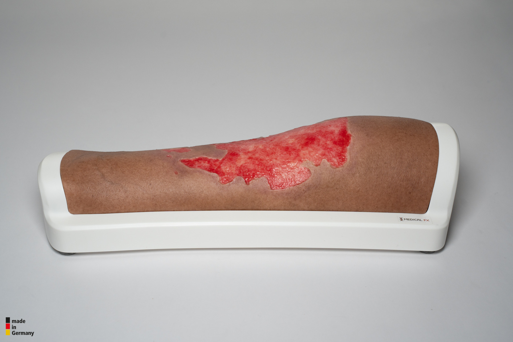 Rahmenmodell Bein mit Brandwunde Grad 3 – Bild 5