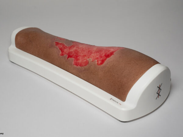 Rahmenmodell Bein mit Brandwunde Grad 3 – Bild 6