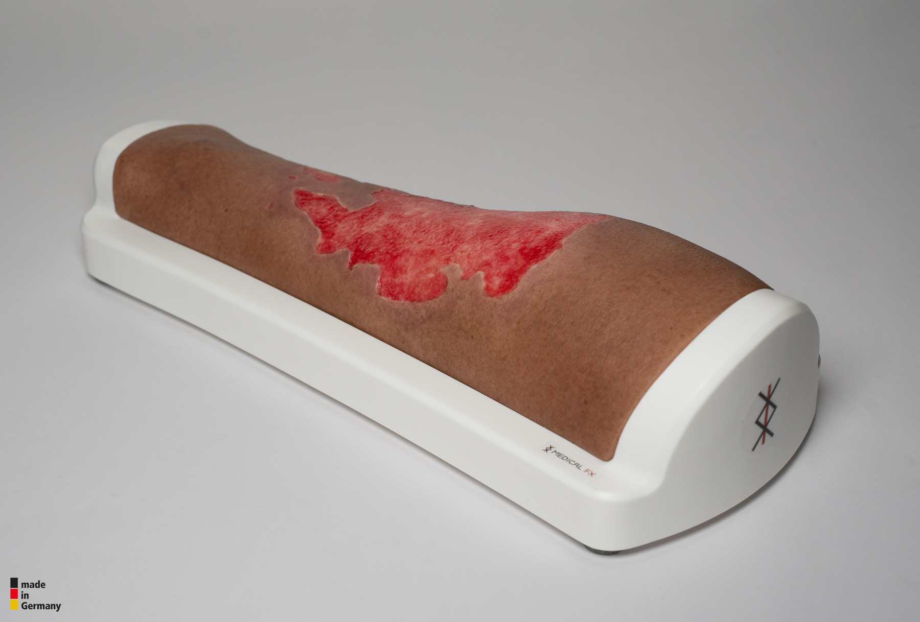 Rahmenmodell Bein mit Brandwunde Grad 3 – Bild 6