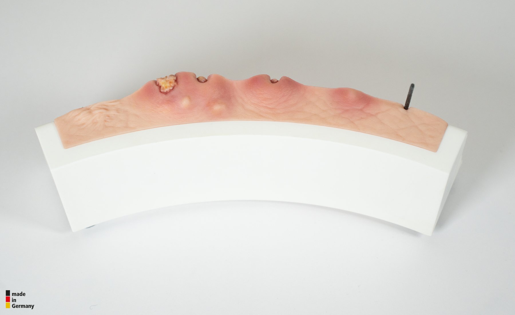 Rahmenmodell Hidradenitis Suppurativa (gebogener Querschnitt) – Bild 14