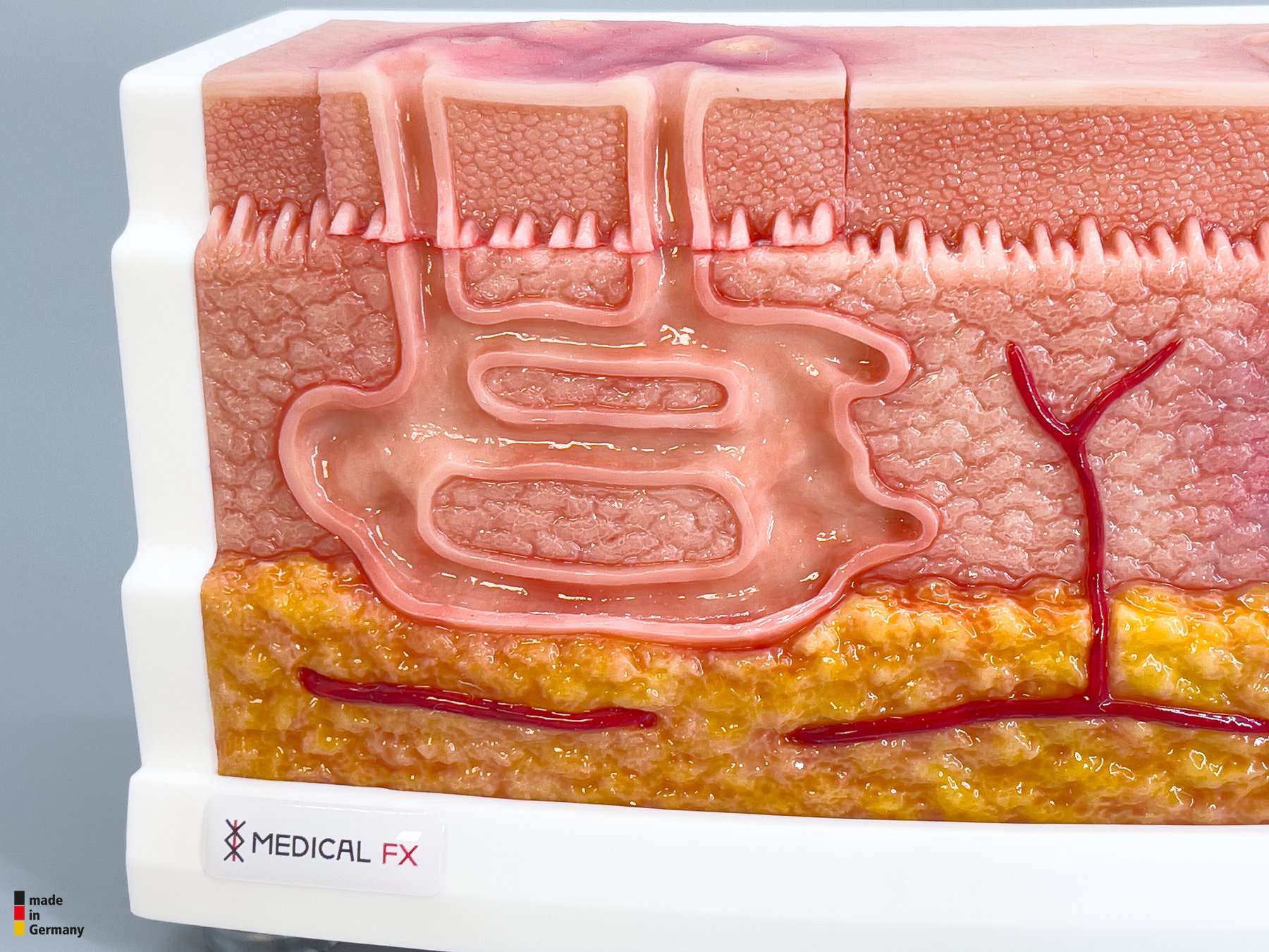 Rahmenmodell Interaktives Modell Hidradenitis Suppurativa – Bild 4