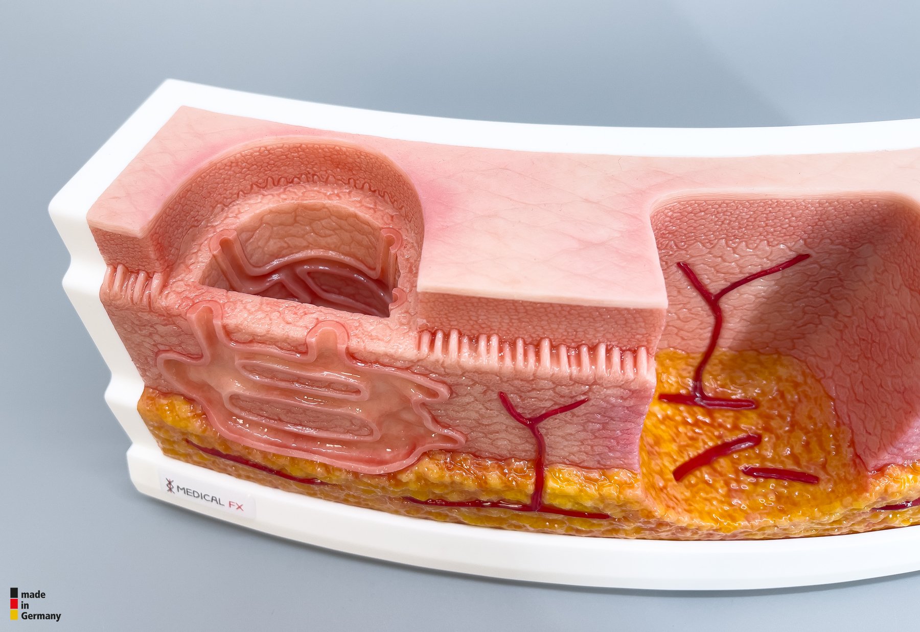 Rahmenmodell Interaktives Modell Hidradenitis Suppurativa – Bild 15