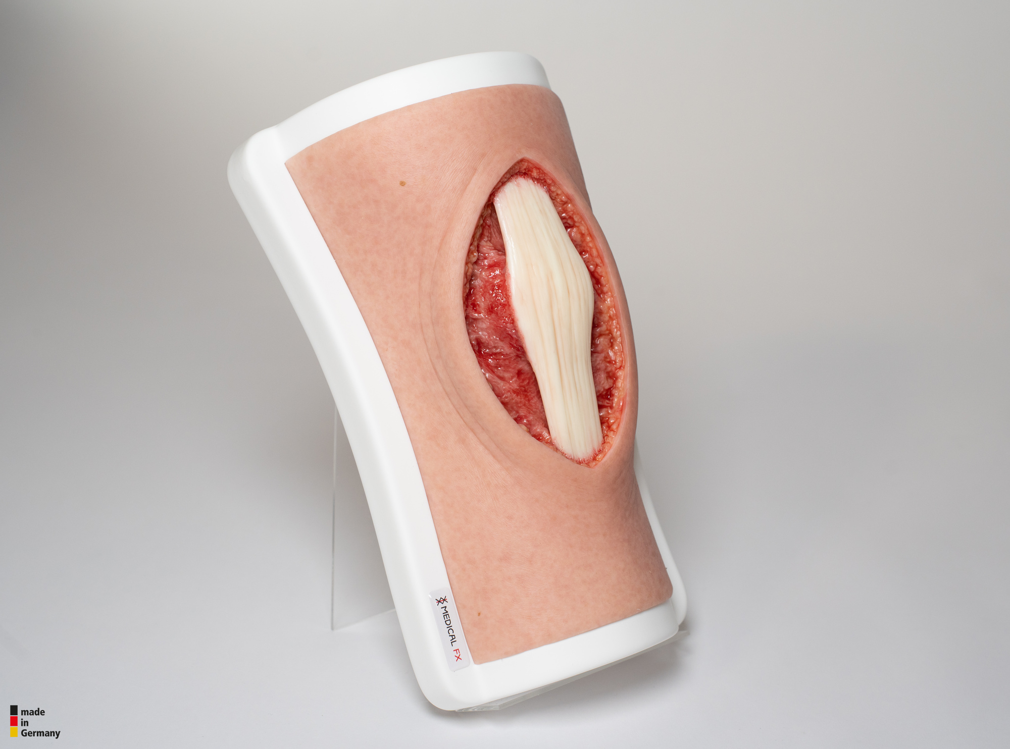 Knie mit 2 freiliegenden Sehnen, Patellasehne, Quadrizepssehne – Bild 4