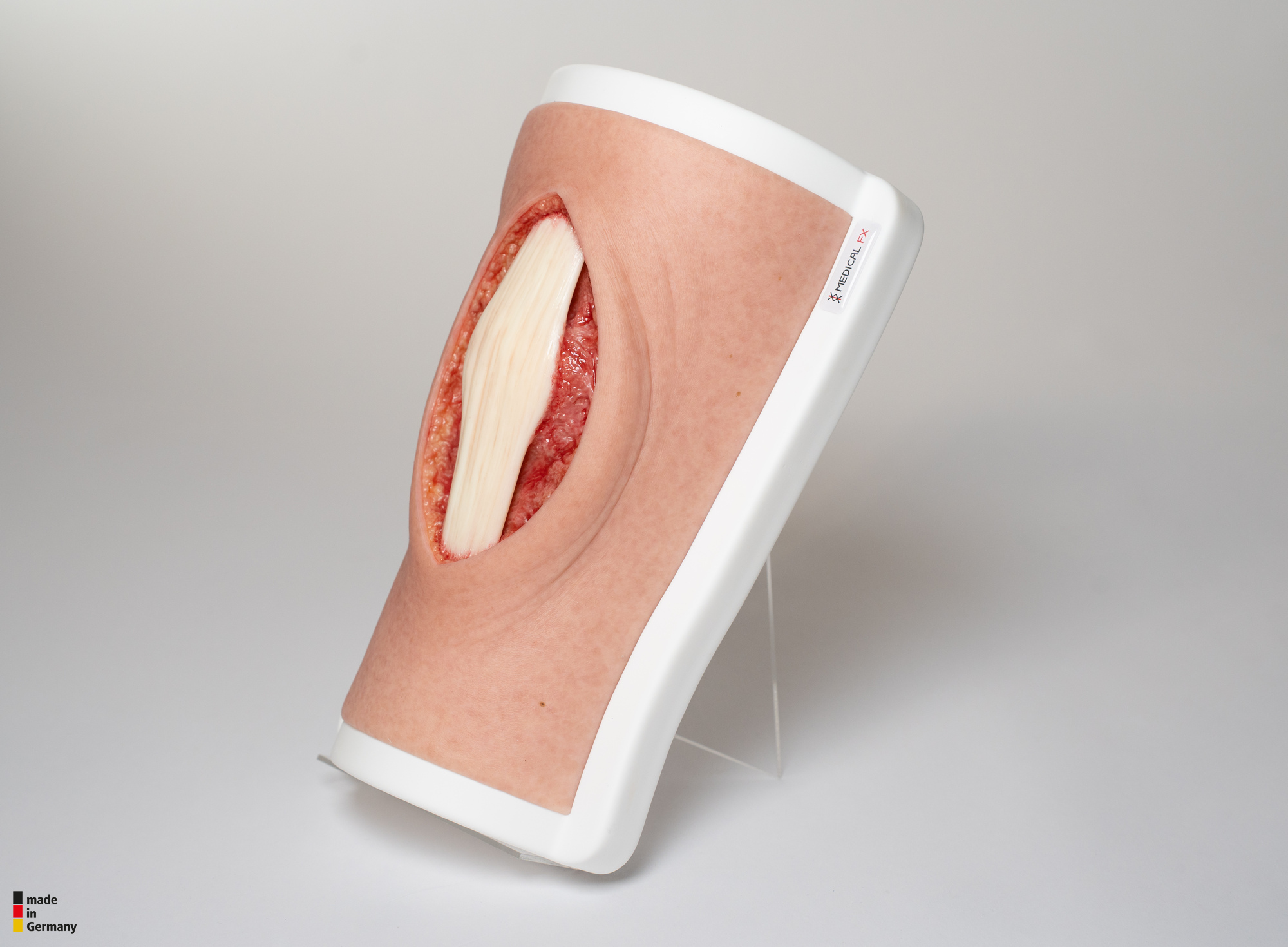 Knie mit 2 freiliegenden Sehnen, Patellasehne, Quadrizepssehne – Bild 3